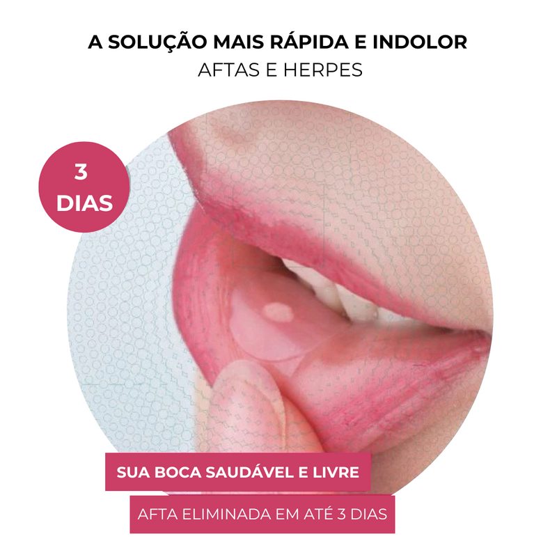 Curativo Para Aftas Lipaid